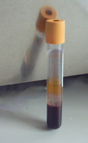 Sstvacutainer_small
